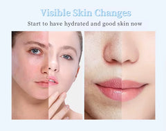 Masque pour le visage HYGROGEL